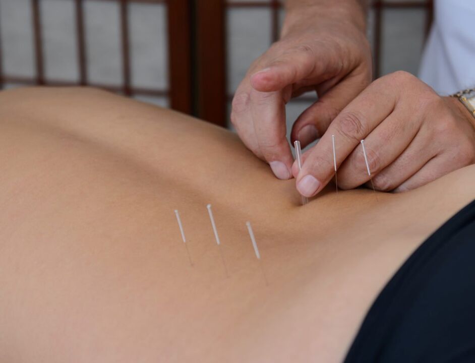akupunktura za prostatitis