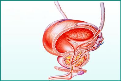 Upala prostate kod akutnog prostatitisa je ograničenje za seks