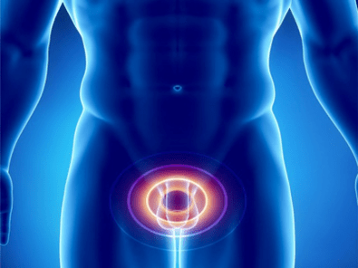 Prostatitis – upala prostate kod muškaraca